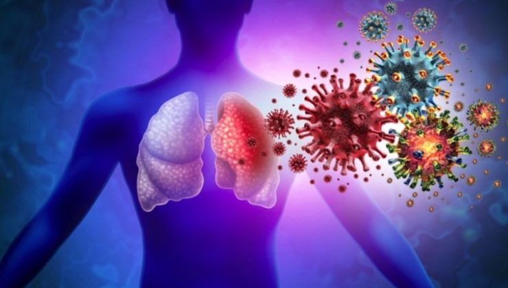 5 maddede zatürre: Belirtileri neler, nasıl bulaşır, hastalıktan nasıl korunabiliriz?