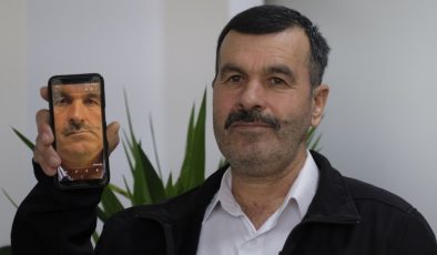 Ağrı ve yüz bozulmalarının sebebi bilinmiyordu, tümör çıktı!