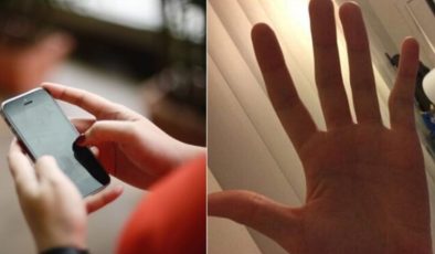 Cep telefonu kullananlara ‘yamuk serçe parmak’ uyarısı: Cerrahi müdahale gerektirebilir!